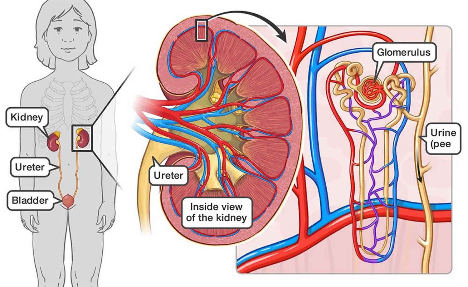 Nephritis | Medicinal Herbs Study Center