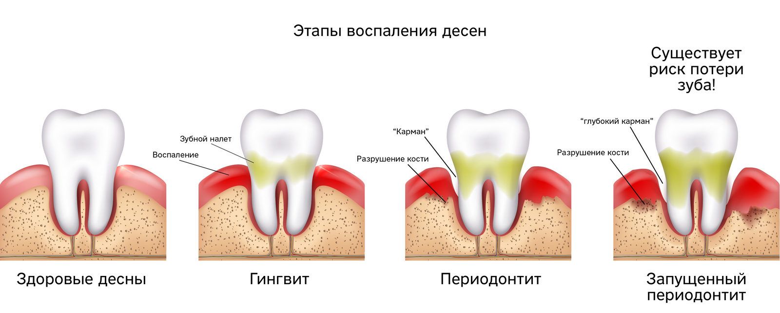 Буйлнаас цус гарах | Эмийн ургамал судлалын төв